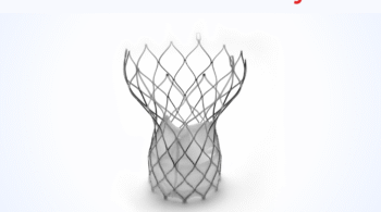 Case Study on Approval of Clinical Investigation on Cardiac Valve